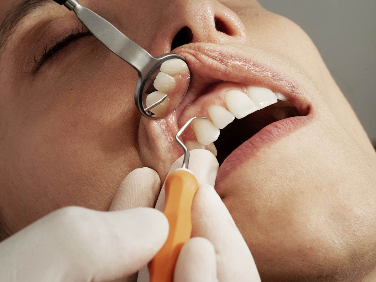 Revisión dental detallada